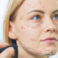Unlocking Timeless Beauty: Exploring the Efficacy of Victoria Facelift – A Comprehensive Review